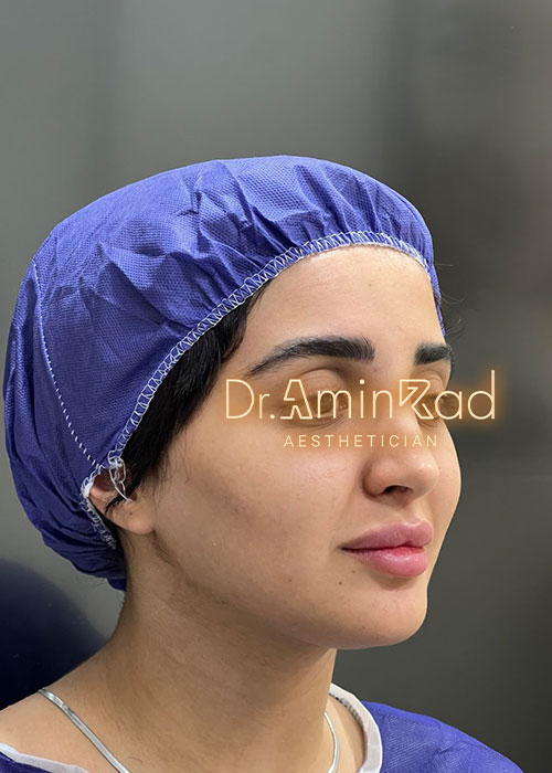 asli-nemone-002