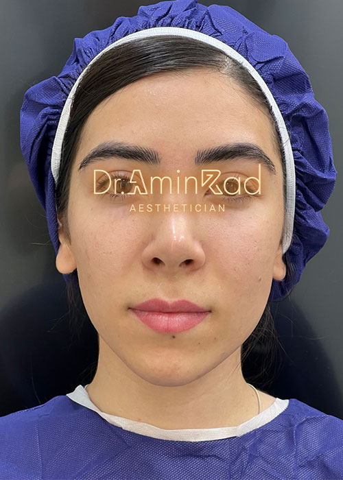 nemone-asli-03