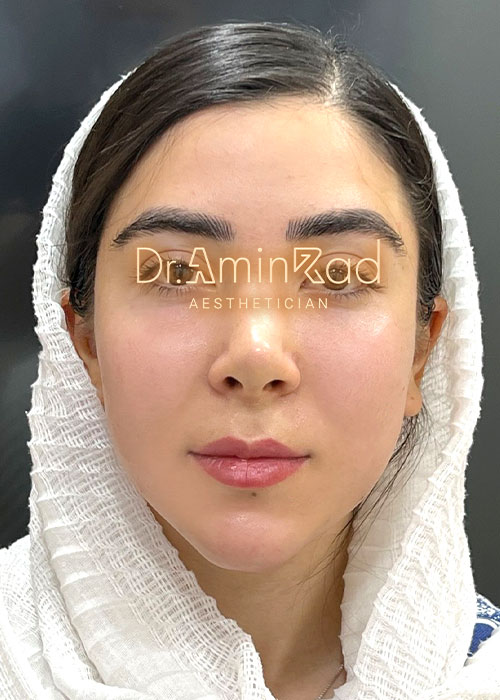 nemone-asli-05